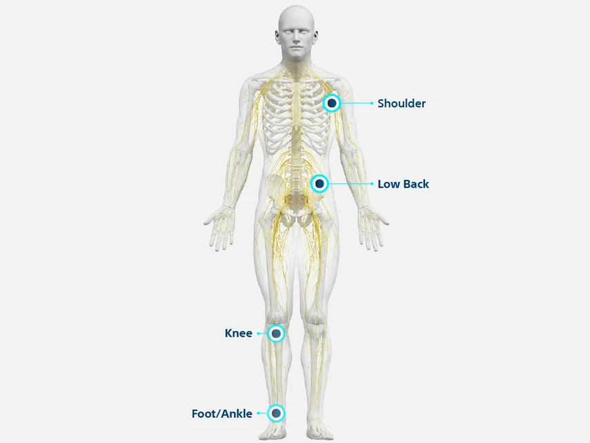 Nalu System